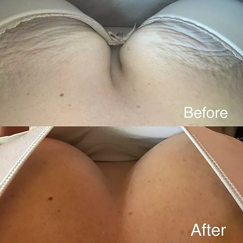 Before and after skin appearance comparison.