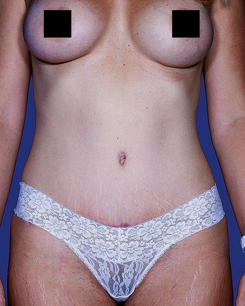 Woman in white lace underwear, body confidence theme.
