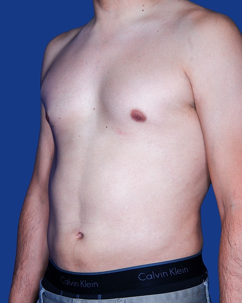 Male torso with Calvin Klein waistband, blue background.