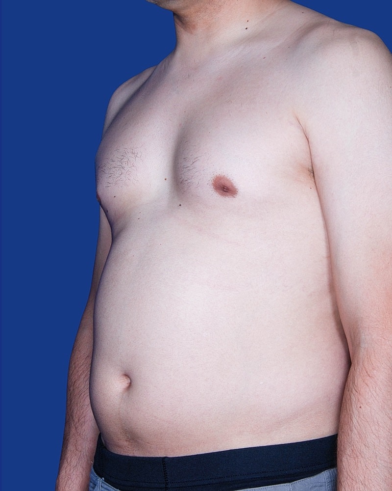 Side view of a man with a slight belly.