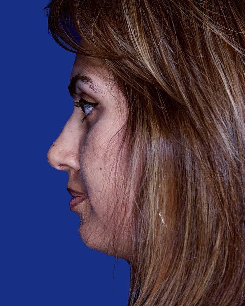 Profile view of a woman with long hair.