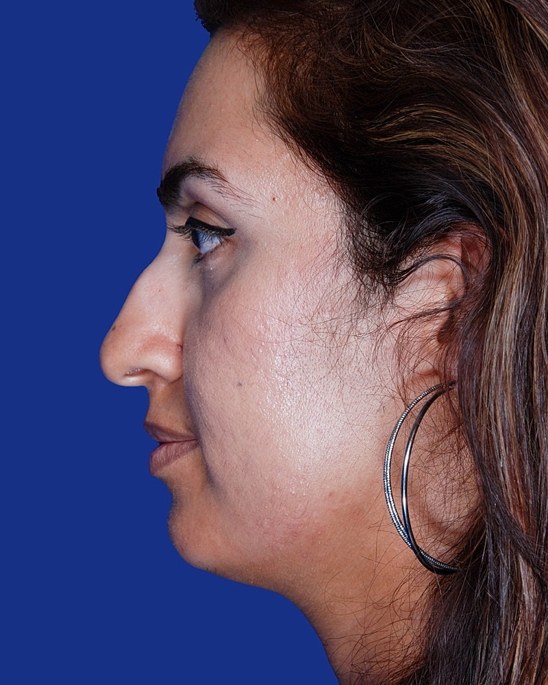 Profile view of a woman with hoop earrings.