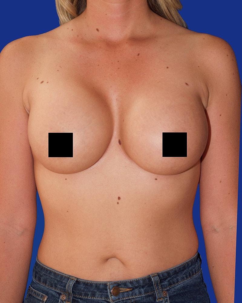 Woman with covered breasts and denim shorts.