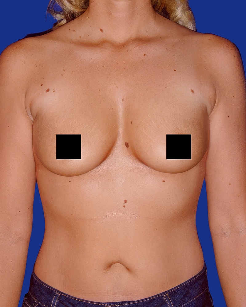 Female torso with covered breasts and blue background