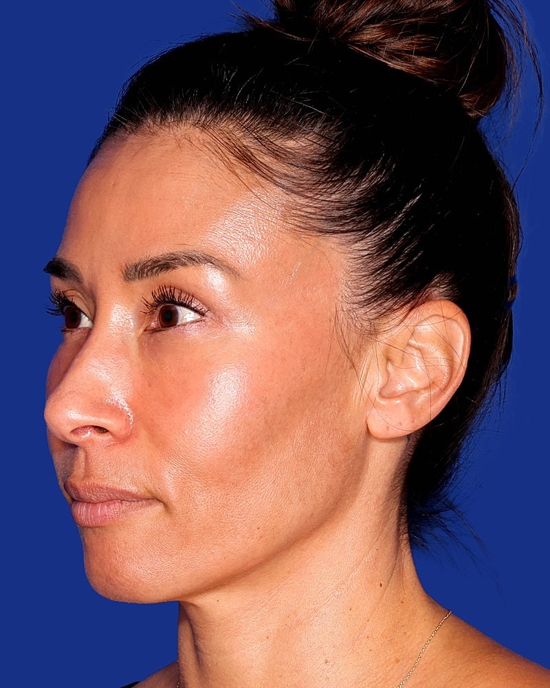 Profile view of a woman against a blue background.