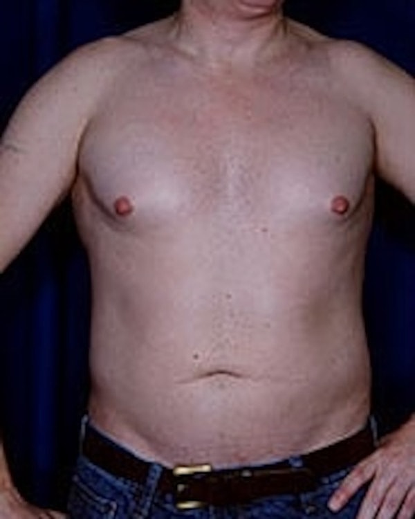Man standing with bare torso and jeans.