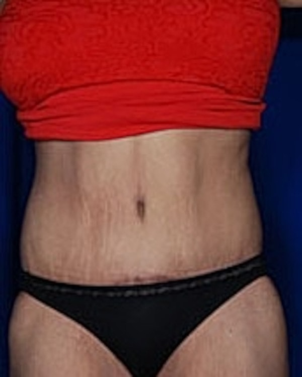 Person in a red top and black underwear.
