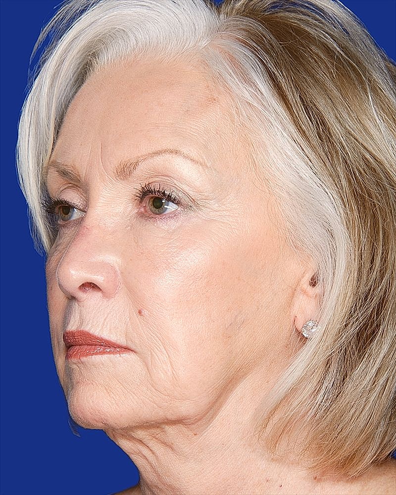 Profile of a mature woman with light hair.