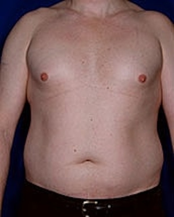 Male torso with visible skin and body contours.