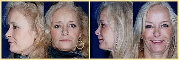 Woman with blonde hair in multiple angles.