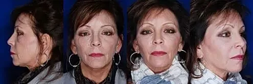 Woman posing from multiple angles against blue background.