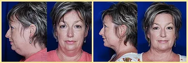 Woman's portraits from multiple angles against blue background.