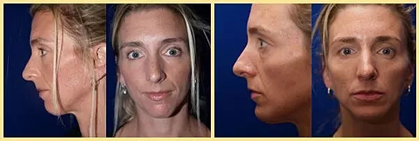 Front and side views of a woman's face.