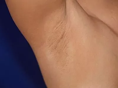 Close-up of underarm skin texture.