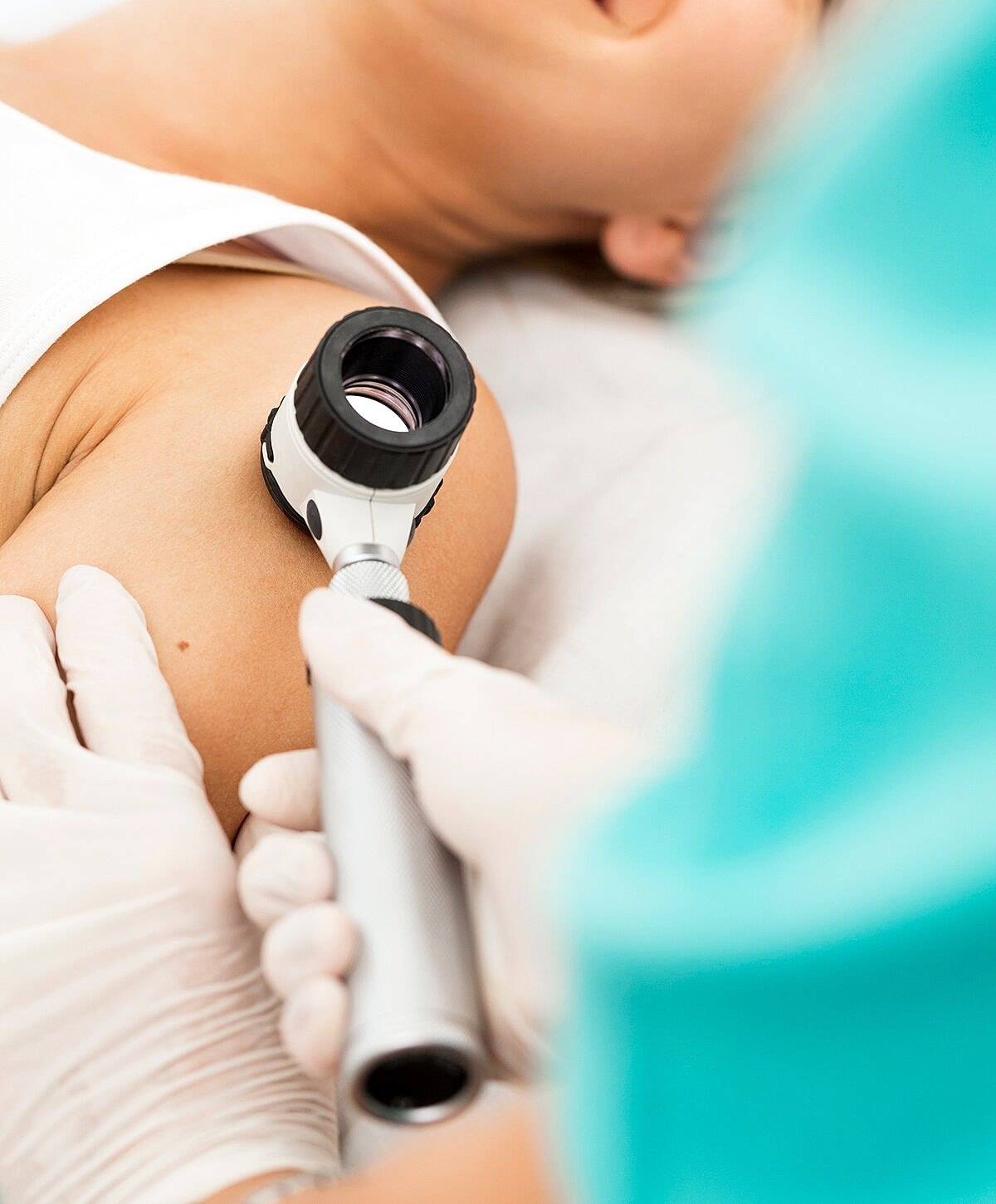 Skin examination using a dermatoscope on patient.