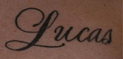Tattoo Removal Before & After