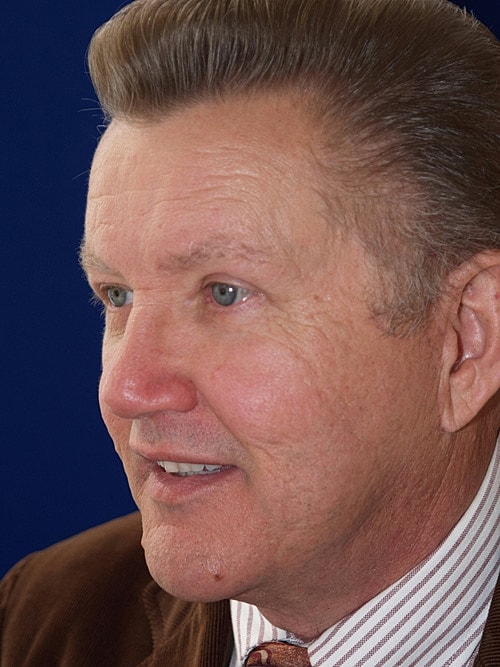 Male Eyelid Surgery Before & After