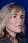 Facelift Before & After