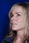Facelift Before & After