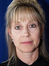 Facelift Before & After