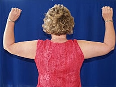 Liposuction Before & After