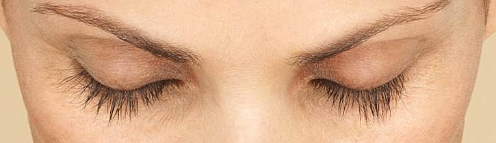 Latisse Before & After
