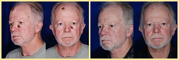Man's changing appearance over time in portraits.