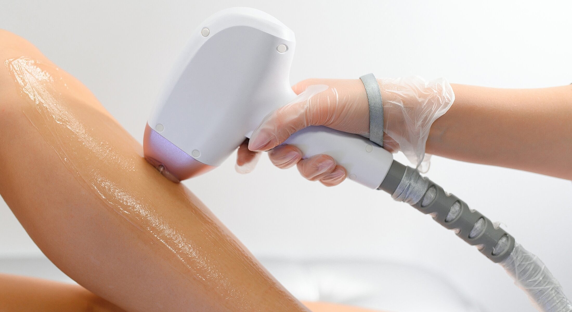 Laser hair removal treatment in progress on leg.