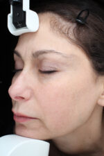 Brown Spots, Wart and Scar Removal