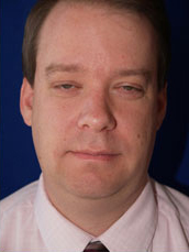 Male Liposuction