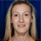 Rhinoplasty