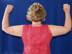Liposuction