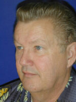 Male Blepharoplasty