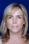 Facelift