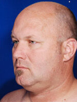 Male Face / Neck