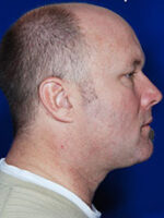 Male Face / Neck