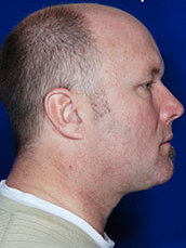 Male Face / Neck