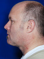 Male Face / Neck