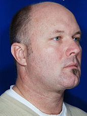 Male Face / Neck