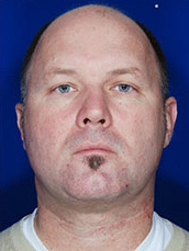 Male Face / Neck