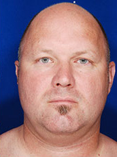 Male Face / Neck