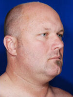 Male Face / Neck