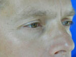Male Face / Neck