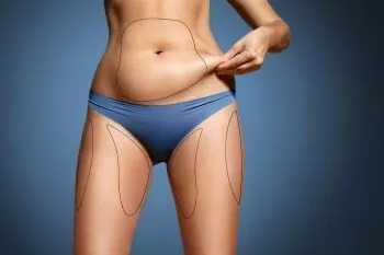 busting myths about liposuction