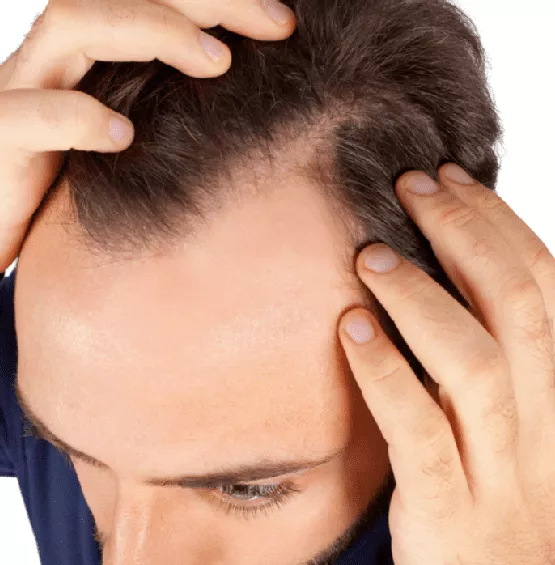 types and causes of hair loss