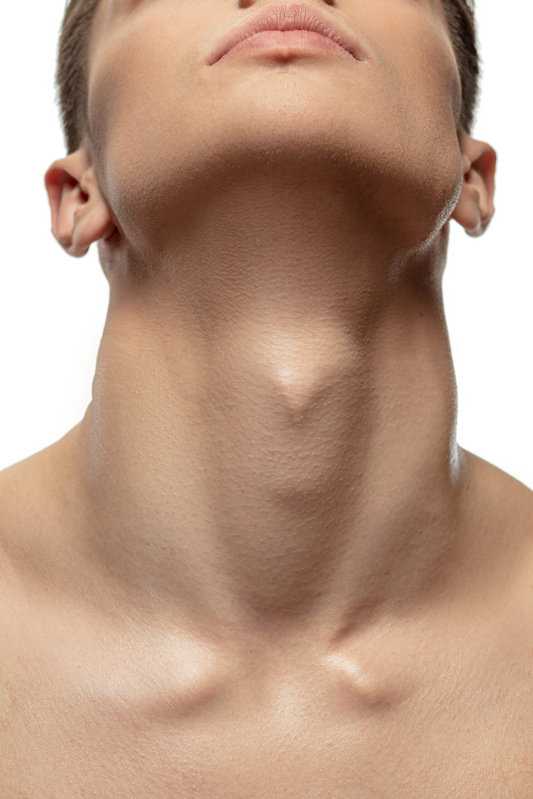 Male neck lift