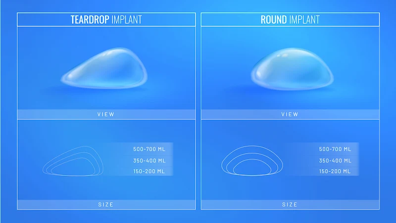 A diagram showing the differences between a teardrop-shaped implant or "Gummy Bear" implant and a round implant