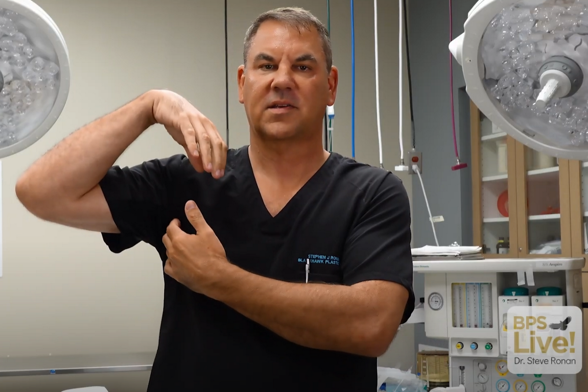 Stephen J Ronan, MD FACS