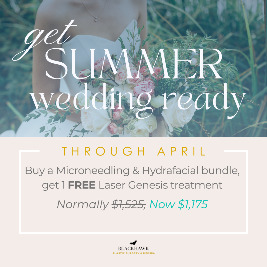 Get Summer Wedding Ready