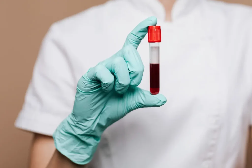 Medical professional holding blood sample tube for hair restoration consultation